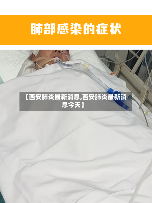 【西安肺炎最新消息,西安肺炎最新消息今天】-第3张图片