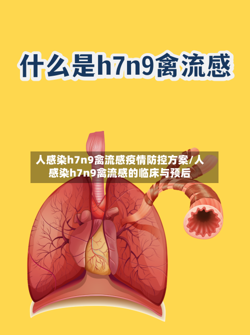 人感染h7n9禽流感疫情防控方案/人感染h7n9禽流感的临床与预后