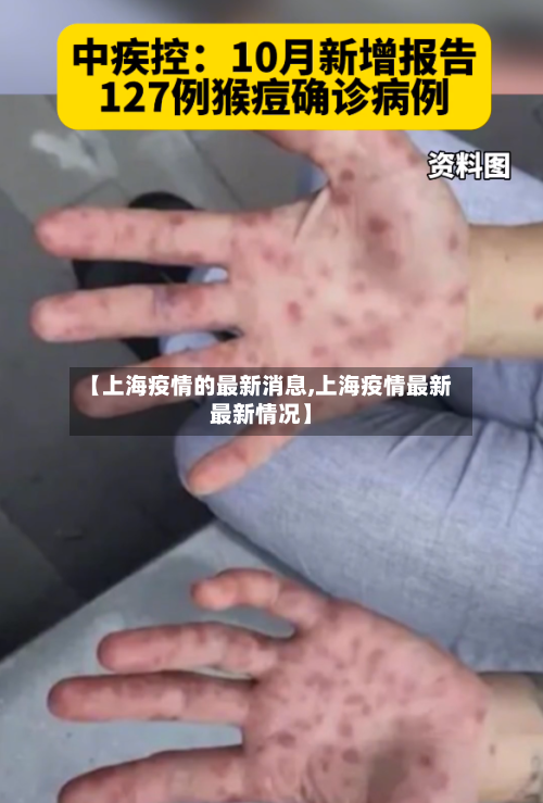 【上海疫情的最新消息,上海疫情最新最新情况】-第2张图片